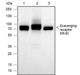 Anti-Human/Rat/Mouse Scavenging Receptor SR-BI Antibody [A648]