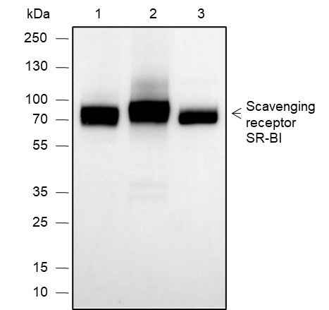 Anti-Human/Rat/Mouse Scavenging Receptor SR-BI Antibody [A648]