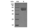 Recombinant Rat PD-L1/B7-H1/CD274 Protein (C-His) - ABMIUM