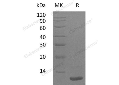 Recombinant Human LR3-IGF-1 Protein (MG) - ABMIUM