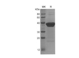 SDS-PAGE analysis of Human ACTN4 proteins, 2 μg/lane of Recombinant Human ACTN4 proteins was resolved with SDS-PAGE under reducing conditions, showing bands at 38 kDa.