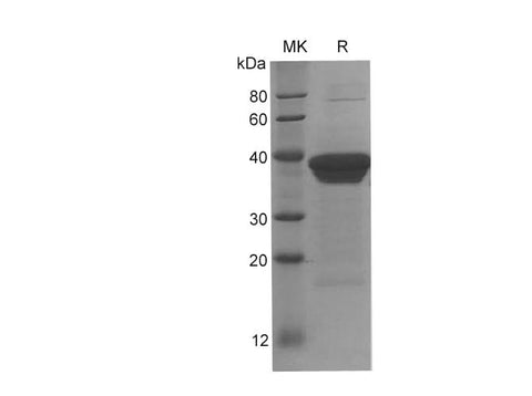SDS-PAGE analysis of Human ACTN4 proteins, 2 μg/lane of Recombinant Human ACTN4 proteins was resolved with SDS-PAGE under reducing conditions, showing bands at 38 kDa.