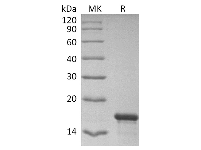 Recombinant SARS-CoV-2 NP NTD domain (His Tag) - ABMIUM