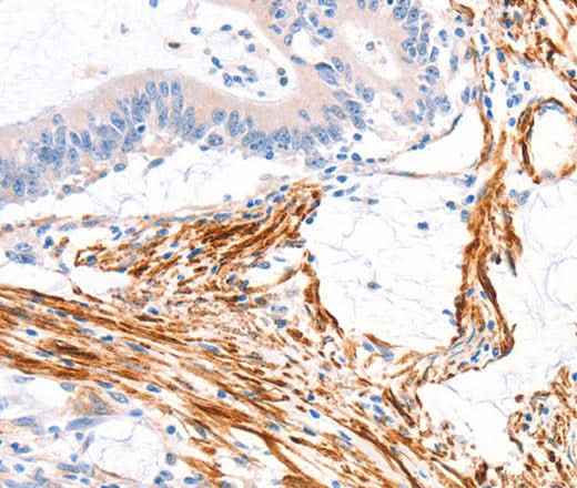 Anti-Human/Mouse ARAP1 Antibody