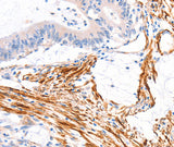 Anti-Human/Mouse ARAP1 Antibody - ABMIUM