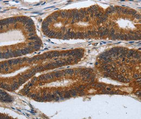 Anti-Human/Mouse PDCD7 Antibody