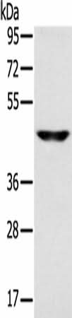 Anti-Human SLC16A8 Antibody - ABMIUM