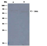 Anti-Human TPH1 Antibody [B334]