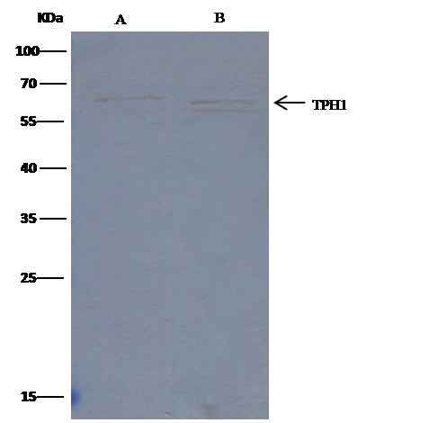 Anti-Human TPH1 Antibody [B334] - ABMIUM