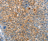 Anti-Human SERPINF2 Antibody - ABMIUM