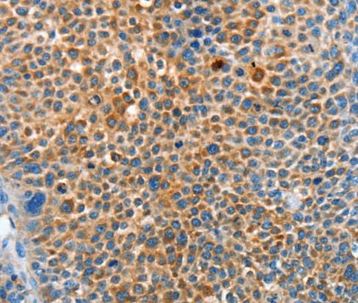 Anti-Human SERPINF2 Antibody - ABMIUM