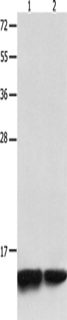 Anti-Human/Mouse/Rat MYL9 Antibody - ABMIUM