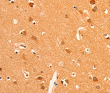 Anti-Human/Mouse/Rat GRM3 Antibody - ABMIUM