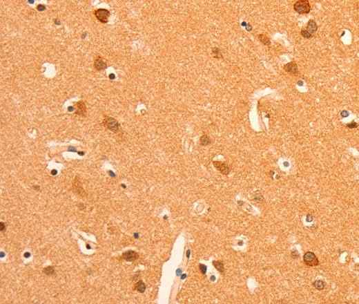 Anti-Human/Mouse/Rat GRM3 Antibody
