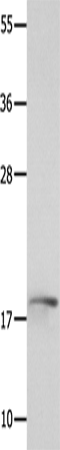 Anti-Human/Mouse NME3 Antibody - ABMIUM