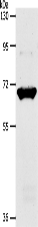 Anti-Human/Mouse/Rat SLC33A1 Antibody - ABMIUM