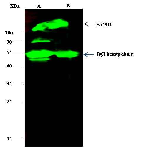 Anti-Human CDH1 Antibody [A1134] - ABMIUM