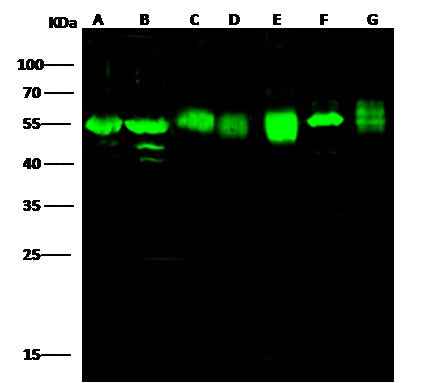 Anti-Human ADSL Antibody [B324] - ABMIUM