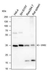 Anti-Human/Rat/Mouse GNB2 Antibody [A234]