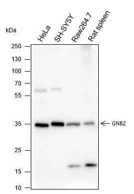 Anti-Human/Rat/Mouse GNB2 Antibody [A234]