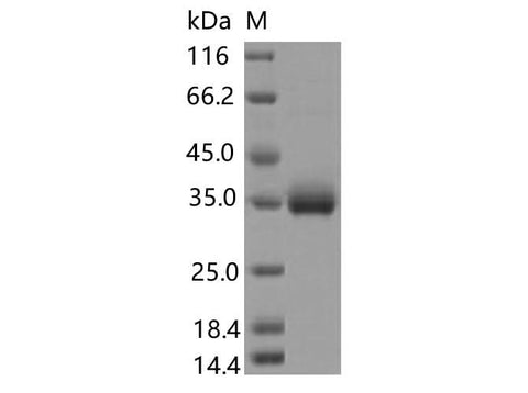 Recombinant SARS-CoV-2 Spike RBD(N440K)(His Tag) - ABMIUM