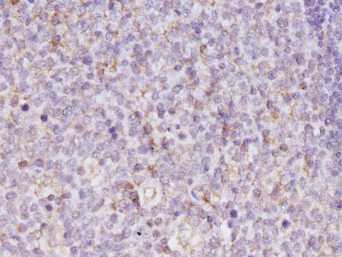 Anti-Human IL-17A Antibody - ABMIUM