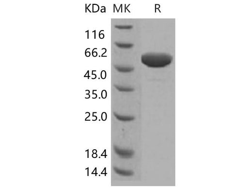 Recombinant Human Apolipoprotein A-I/ApoAI Protein (Fc Tag) - ABMIUM