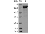 Recombinant Human FAM171B/KIAA1946 Protein (Fc Tag) - ABMIUM