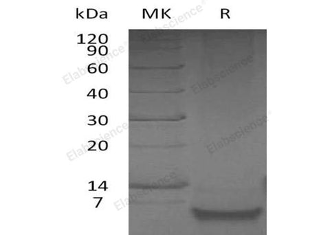 Recombinant Human β-Defensin 1/DEFB1 Protein - ABMIUM