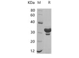 SDS-PAGE analysis of Mouse KRT18 proteins, 2 μg/lane of Recombinant Mouse KRT18 proteins was resolved with SDS-PAGE under reducing conditions, showing bands at 27.78 kDa.