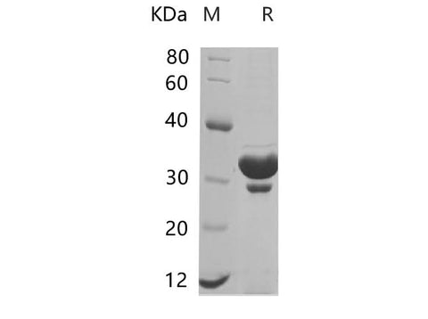 SDS-PAGE analysis of Mouse KRT18 proteins, 2 μg/lane of Recombinant Mouse KRT18 proteins was resolved with SDS-PAGE under reducing conditions, showing bands at 27.78 kDa.