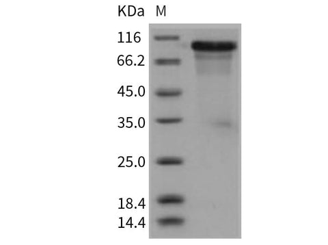 > 88 % as determined by reducing SDS-PAGE.