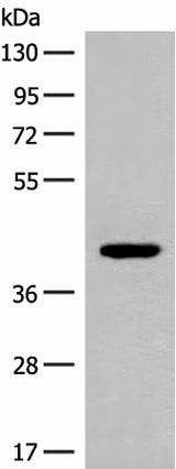 Western blot analysis of 293T cell lysate using FCGRT Polyclonal Antibody at dilution of 1:500