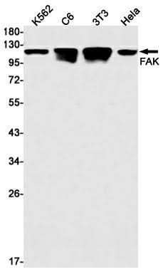 Western blot detection of FAK in K562,C6,3T3,Hela cell lysates using FAK Rabbit mAb(1:1000 diluted).Predicted band size:119kDa.Observed band size:125kDa.