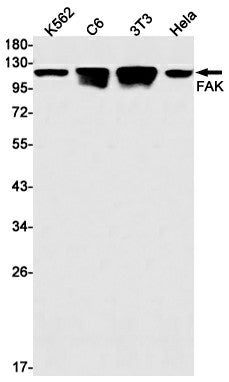 Western blot detection of FAK in K562,C6,3T3,Hela cell lysates using FAK Rabbit mAb(1:1000 diluted).Predicted band size:119kDa.Observed band size:125kDa.