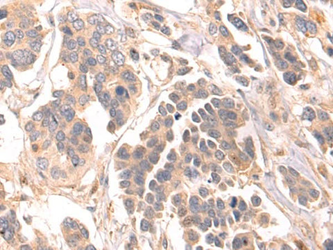 Anti-Human/Mouse/Rat LRRC15 Antibody - ABMIUM