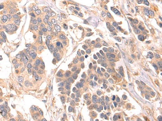 Anti-Human/Mouse/Rat LRRC15 Antibody - ABMIUM