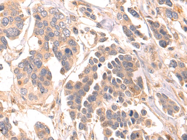 Anti-Human/Mouse/Rat LRRC15 Antibody - ABMIUM