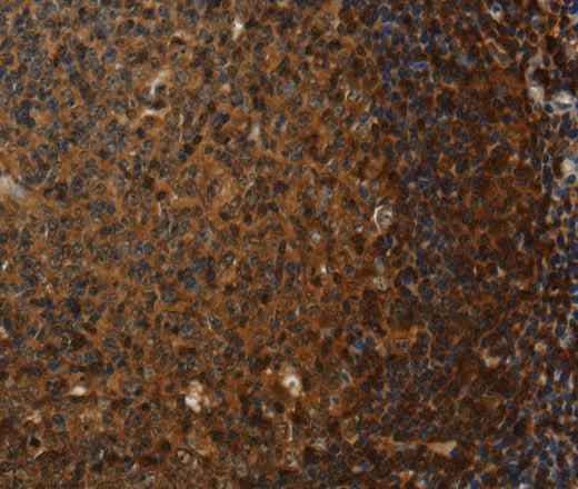 Anti-Human CLDN8 Antibody
