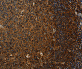 Anti-Human CLDN8 Antibody - ABMIUM