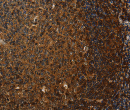 Anti-Human CLDN8 Antibody - ABMIUM