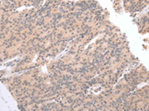 Anti-Human DEFB112 Antibody