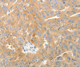 Anti-Human TEP1 Antibody - ABMIUM