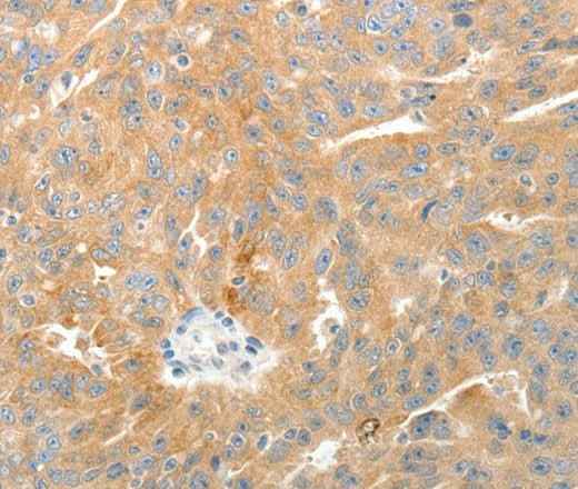 Anti-Human TEP1 Antibody