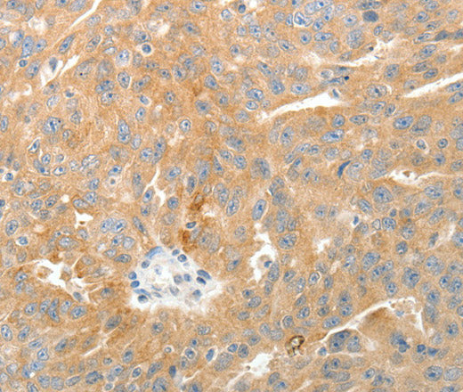 Anti-Human TEP1 Antibody - ABMIUM