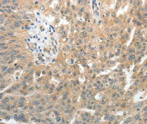 Anti-Human E-Selectin Antibody