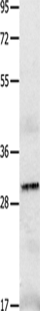 Anti-Human/Mouse/Rat IL2RA Antibody - ABMIUM