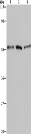 Anti-Human/Mouse/Rat BAG5 Antibody - ABMIUM