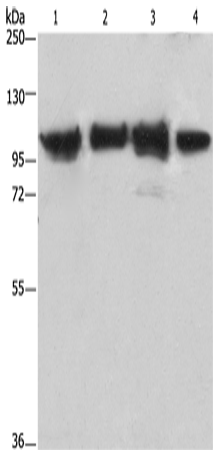 Anti-Human/Mouse/Rat ACTN4 Antibody - ABMIUM