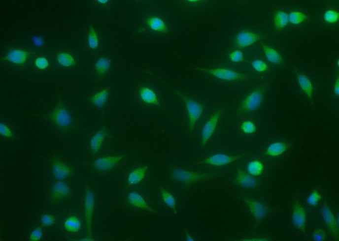 Anti-Human/Mouse/Rat/Rhesus/Canine BMP2 Antibody [A1171] - ABMIUM